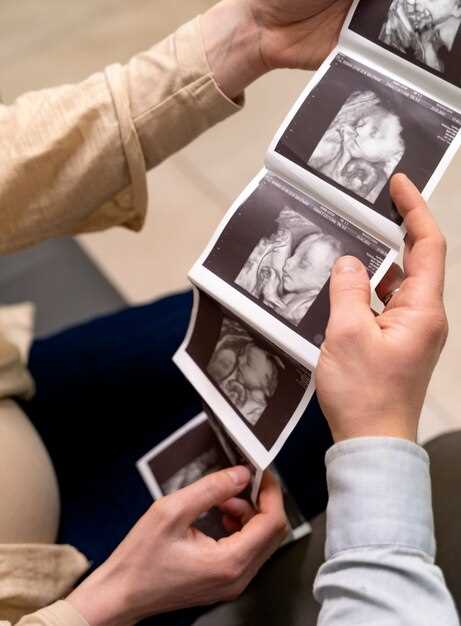 Определение пола ребенка по УЗИ на неделе беременности